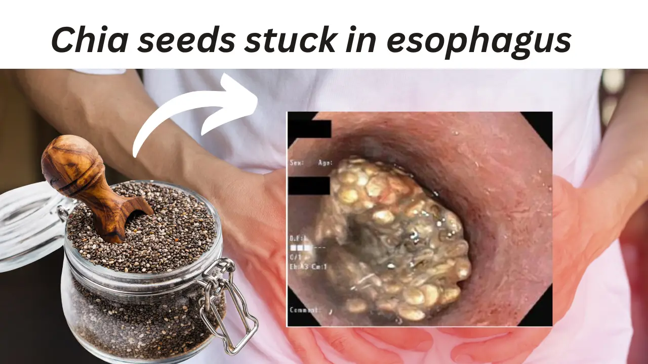 chia seed side effects 